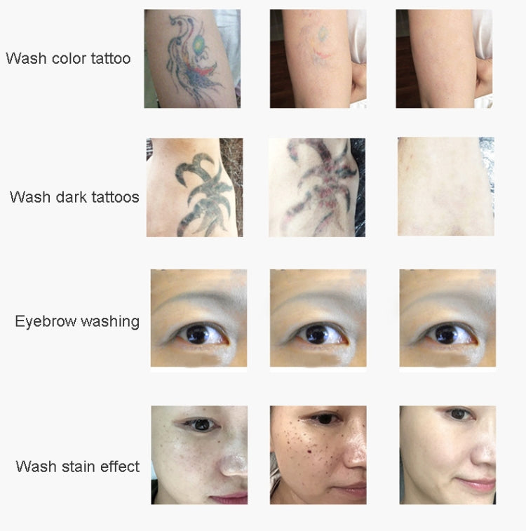 Laser Tattoo Removal Machine Non-invasive Eyebrow Washing Beauty Equipment(US Plug) - Beauty Instrument by PMC TechLife | Online Shopping South Africa | PMC TechLife