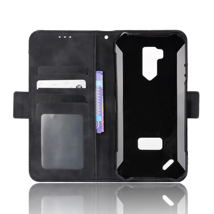 For Ulefone Armor X9 Skin Feel Calf Pattern Leather Phone Case(Black) - Ulefone Cases by PMC Jewellery | Online Shopping South Africa | PMC Jewellery | Buy Now Pay Later Mobicred