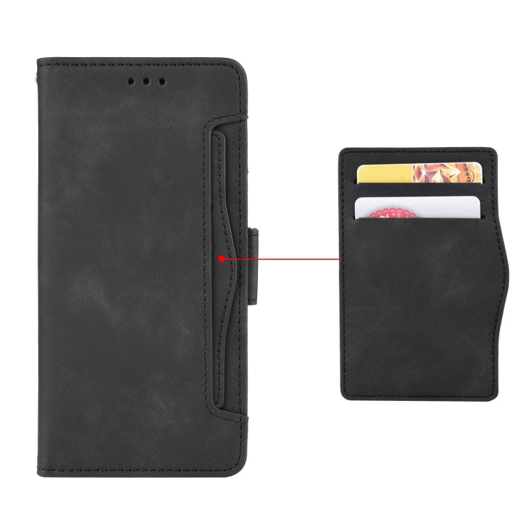 For Ulefone Armor X9 Skin Feel Calf Pattern Leather Phone Case(Black) - Ulefone Cases by PMC Jewellery | Online Shopping South Africa | PMC Jewellery | Buy Now Pay Later Mobicred