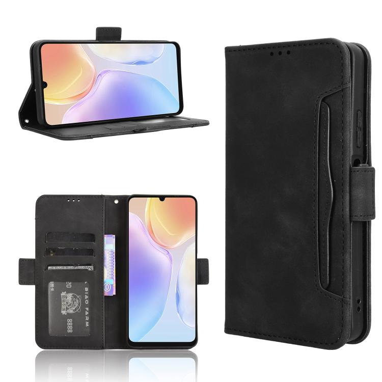 For Ulefone Note 20 Pro Skin Feel Calf Texture Card Slots Leather Phone Case(Black) - Ulefone Cases by PMC TechLife | Online Shopping South Africa | PMC TechLife | Buy Now Pay Later Mobicred
