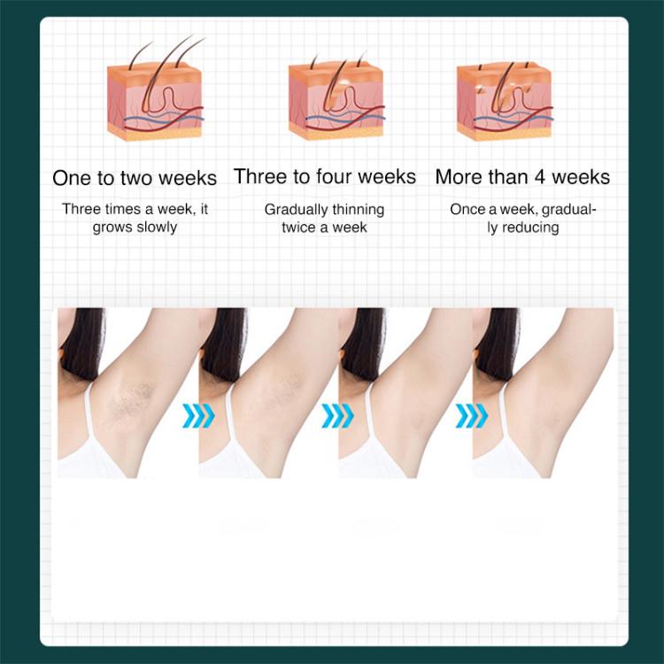 FY-B501 Laser Hair Removal Device Home Electric IPL Intense Pulse Hair Remover, UK Plug(Dark Green) - free shipping - PMC TechLife - Order now!