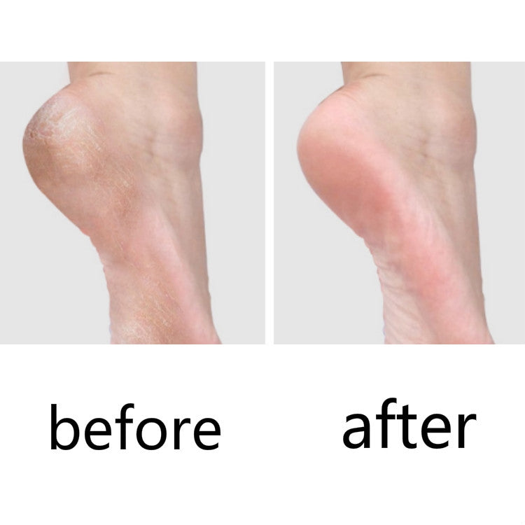 10 PCS Pedicure Knife For Dead Skin Calluses - free shipping - PMC TechLife - Order now!