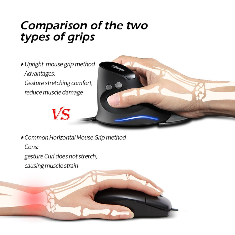 ZELOTES T30 6-keys Vertical Grip Detachable Ergonomic Wired Mouse(7-color Breathing Light) - free shipping - PMC TechLife - Order now!