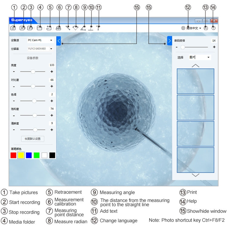 Supereyes Y001 Ear Mite Mouth Electronic Digital Fixed Focus Endoscope - free shipping - PMC TechLife - Order now!