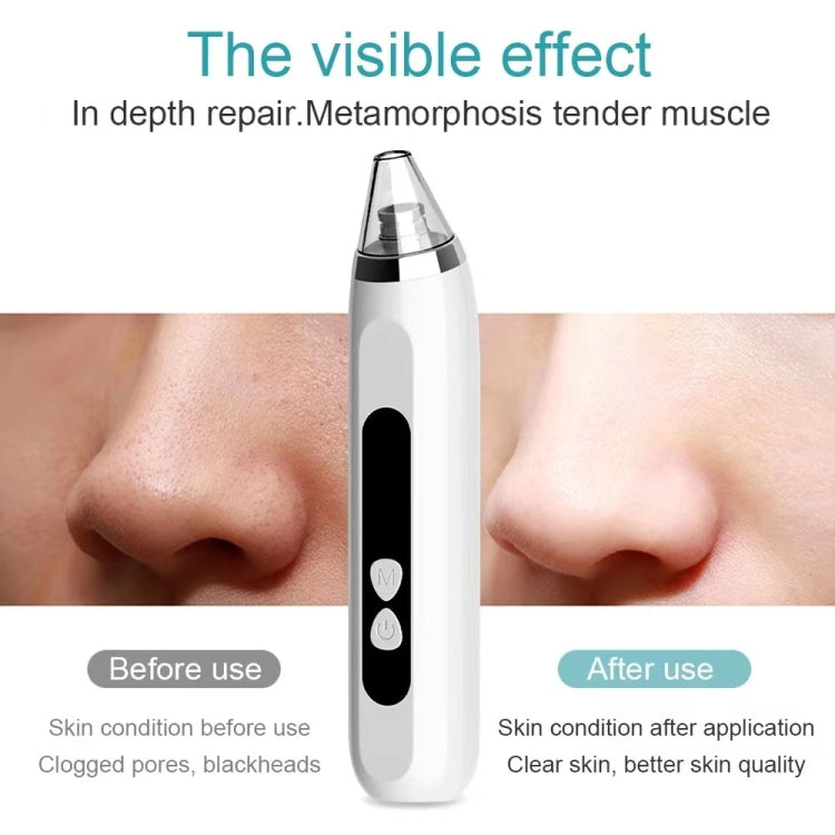 Blackhead Remover Vacuum Pore Cleaner Facial Deep Cleaning Beauty Tools(Pink) - Cleanser by PMC TechLife | Online Shopping South Africa | PMC TechLife